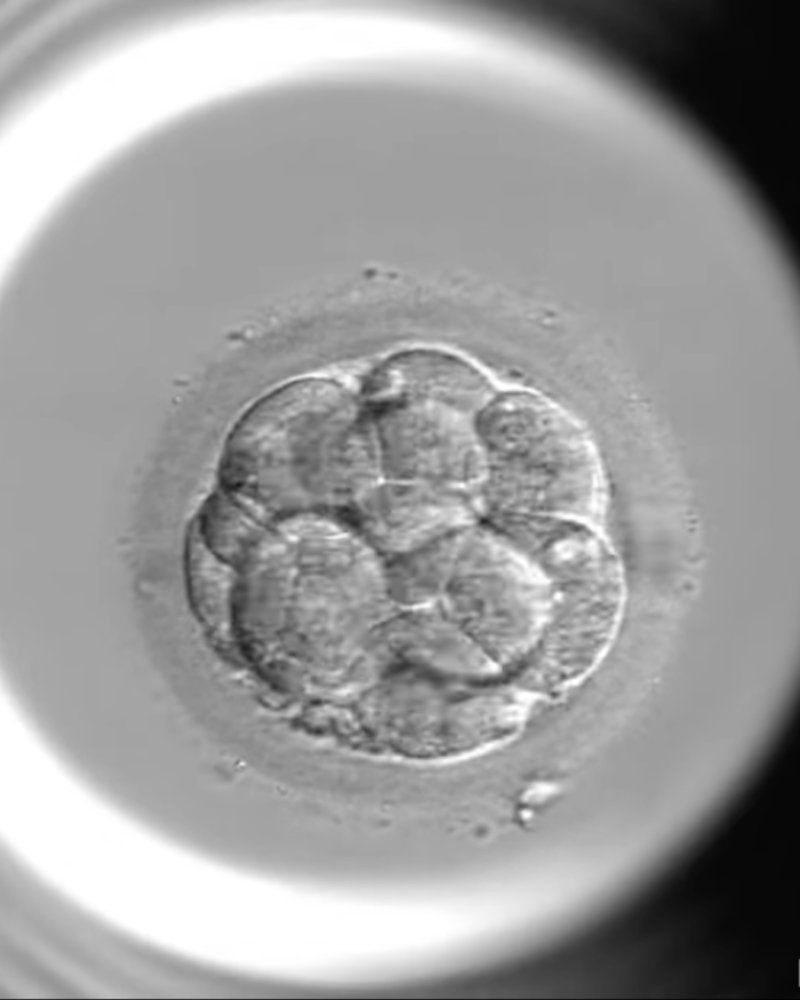 Embryonalentwicklung zur Blastozyste von Tag 1 bis 5 im Time-Lapse-Inkubator
